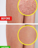 نمک بدن الوئه ورا